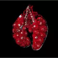 capillary blood supply of the early lung 