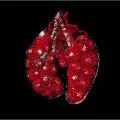 capillary blood supply of the early lung