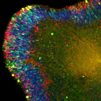 Stem cell-derived retina, web.jpg