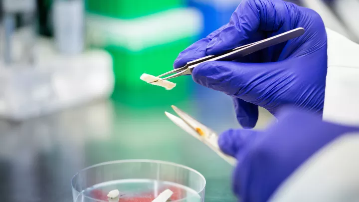 Hands in blue latex gloves use tweezers to hold a small white object above a petri dish. 