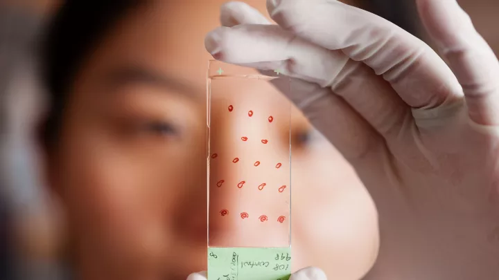 Safety-gloved hands hold a microscope slide. Tiny red samples dot the slide. A blurry face is in the background.