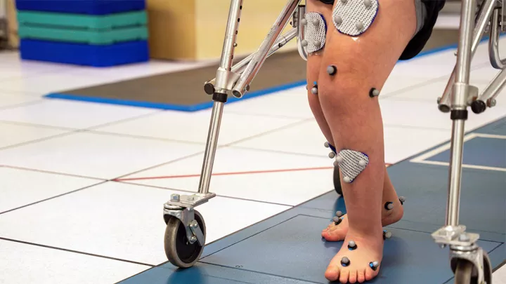 Closeup of toddler's legs marked with gait analysis stickers and sensors