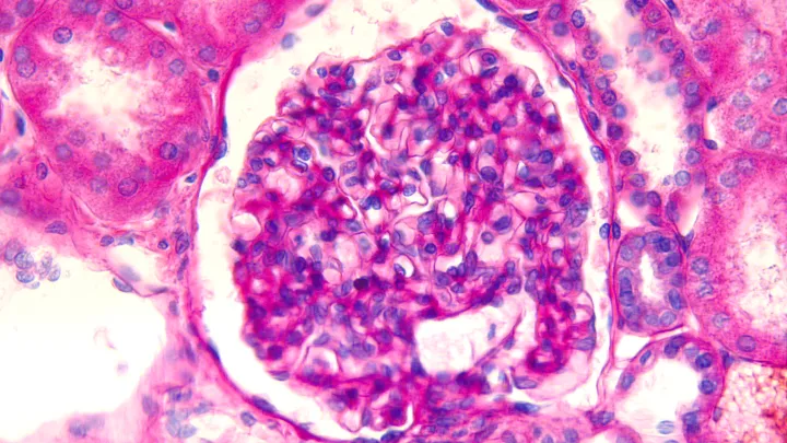 Microscopic picture of a glomerulus in human kidney