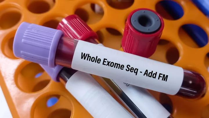 A closeup photo of four test tubes with multicolored lids sitting in an orange test tube holder, one of which has a white label that reads, “Whole Exome Seq - Add FM.”