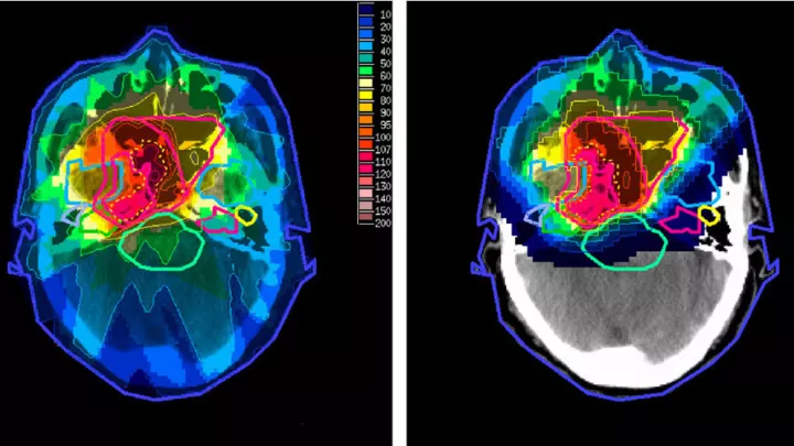 Composite of four brightly colored brain scan images