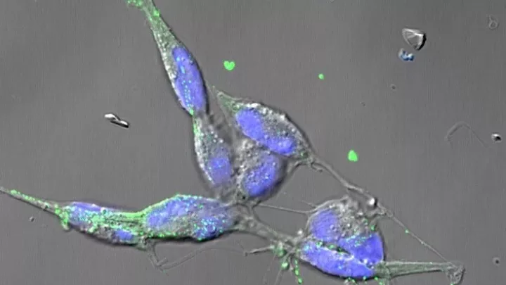 10E4_CHLA90_2[2] (tumor-associated macrophages)