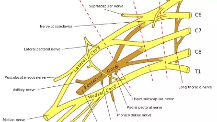 Brachial Plexus Photo 1.jpg