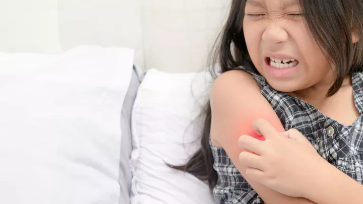 Young girl grimacing while scratching her arm due to ringworm