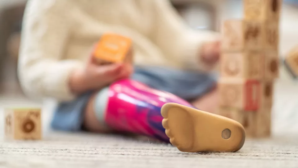 Toddler with prosthetic lower leg plays with building blocks