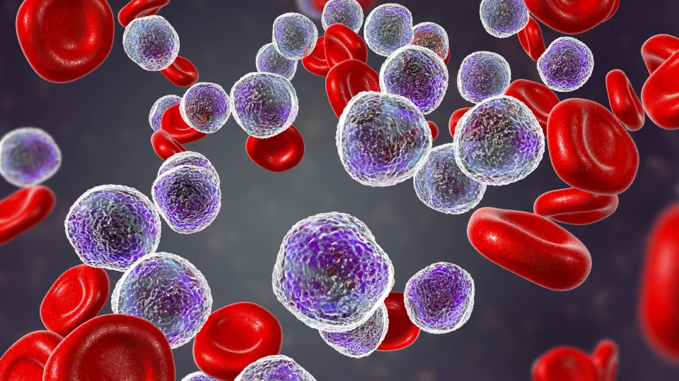 Computer illustration showing abundant lymphoblast cells in human bone marrow