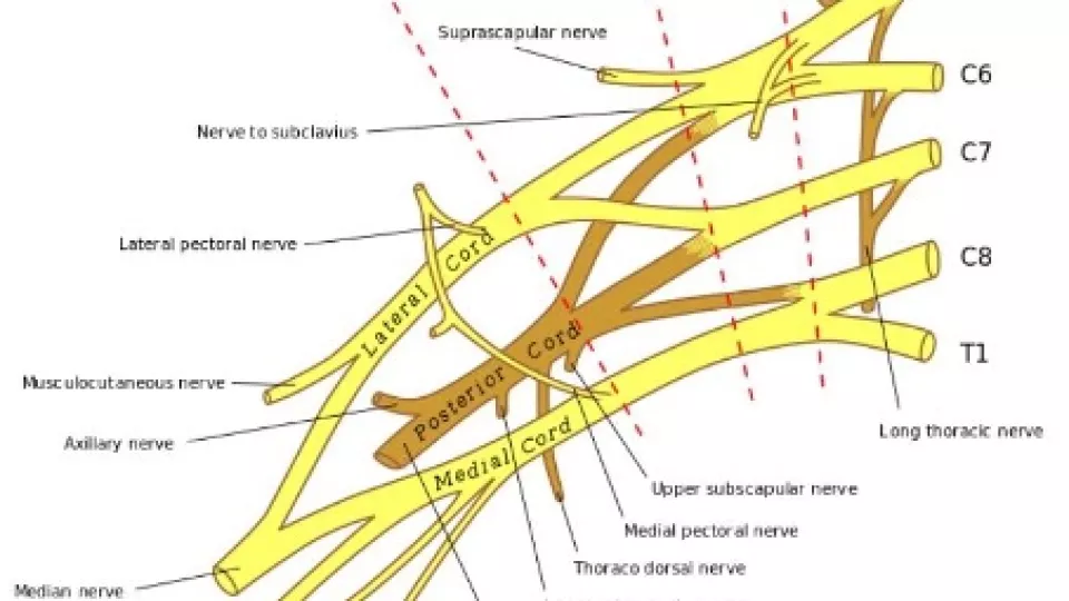 Brachial Plexus Photo 1.jpg