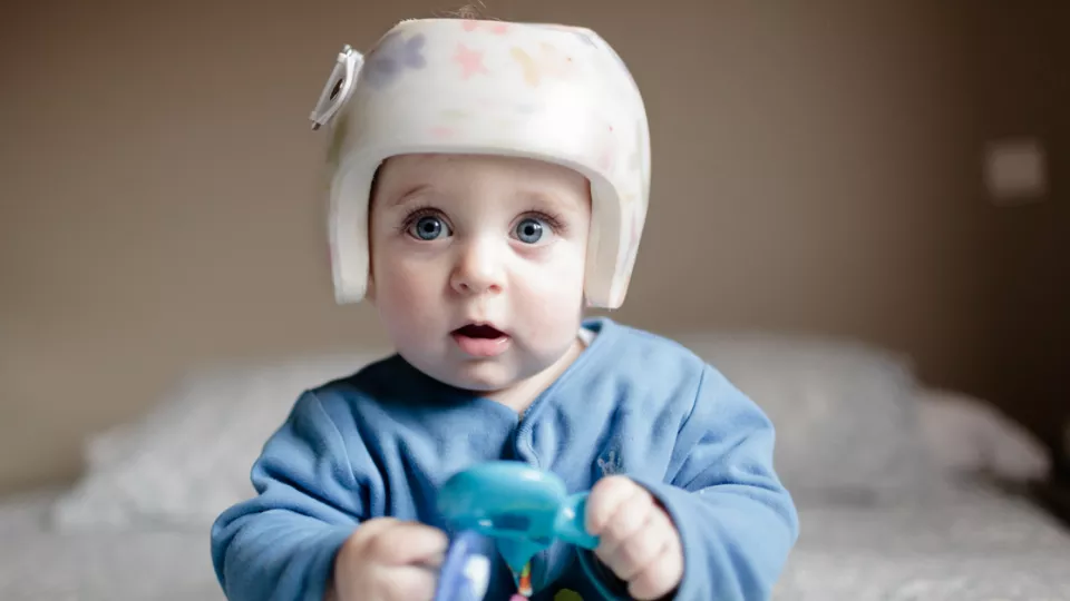 Cute baby boy wearing a helmet to correct plagiocephaly | Children's Hospital Los Angeles