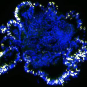 CHLA-Kohli-Figure 3 - Ileal enteroid cultures Intestinal tissue from C57bl6 mice was used to grow enteroids..jpg