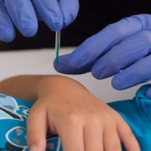 Close up of hands in surgical gloves applying an acupuncture needle to a child's wrist
