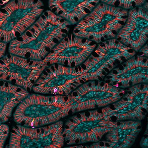 Brightly colored scanned image of human cells