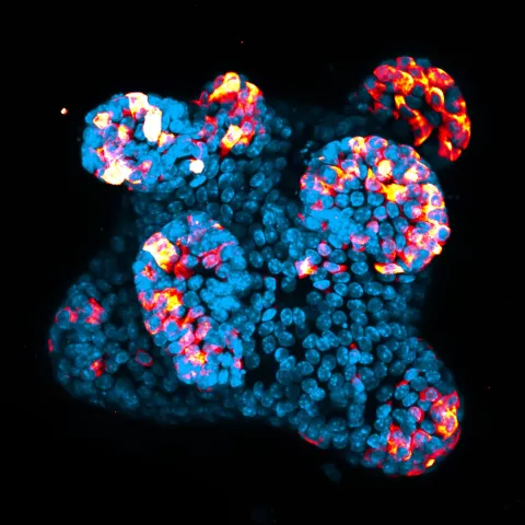 Brightly colored scanned image of human cells