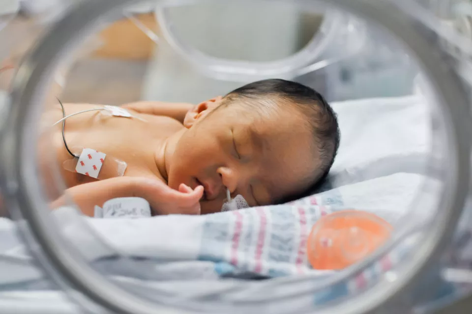 A newborn baby lays sleeping in an incubator. A tube is placed in their nose and wires are attached to their chest.