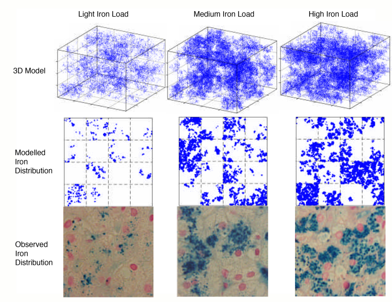 Iron Load Distribution