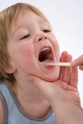 A boy opens his mouth to have his throat examined.