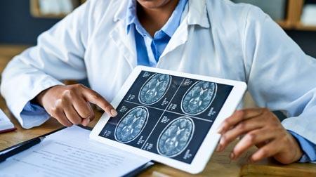 Neurologist holding a brain scan image