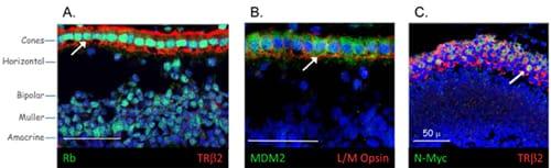 Immunofluorescence images of human retina