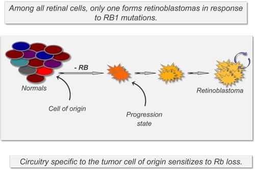 Diagram of retinoblastoma formation