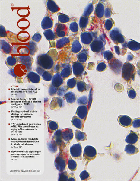 Cover, ALL leukemia article.png