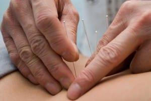 chla-rn-remedies-acupuncture.jpg