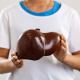 CHLA-Blog-What-Is-Fatty-Liver-Disease-01.jpg CHLA-Blog-What-Is-Fatty-Liver-Disease-01.jpg