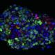 CHLA-Neuro-DIPG-1200x628.jpg CHLA-Neuro-DIPG-1200x628.jpg