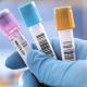 CHLA-vials-gettyimages-961182020-1200x628.jpg CHLA-vials-gettyimages-961182020-1200x628.jpg