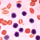 Leukemia_Hero.png Leukemia_Hero.png