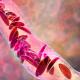 SickleCell.jpg SickleCell.jpg