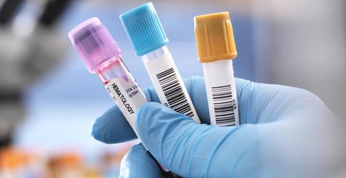 CHLA-vials-gettyimages-961182020-1200x628.jpg