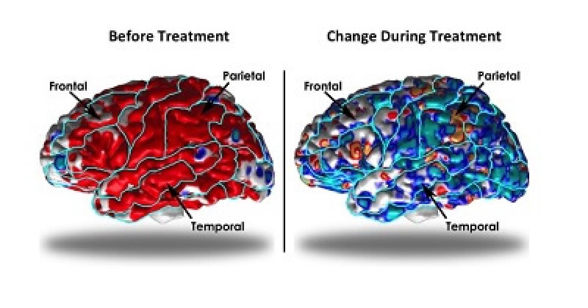 The genetic architecture of the human cerebral cortex