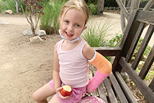 Paker enjoys an apple on a bench with her arm in a cast