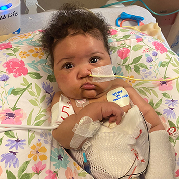 Ciara, a medium skin-toned infant, rests on a hospital pillow with a feeding tube in her nostril and sensors attached to her chest