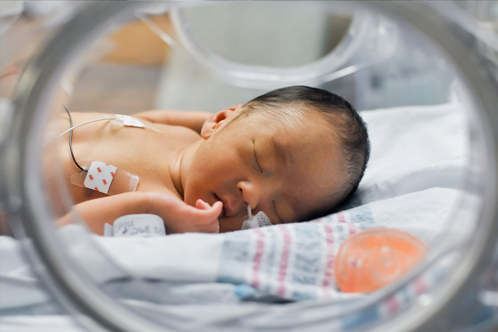 Medium skin tone infant rests in hospital NICU incubator with feeding tube in nostril and small monitoring pads attached to chest