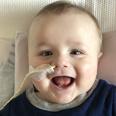 Young Oliver smiles wide despite a feeding tube in his nose
