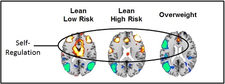 CHLA-fMRI-Obesity450.jpg