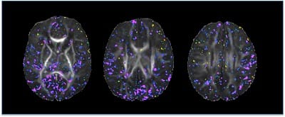 Newborn brain images V2.jpg