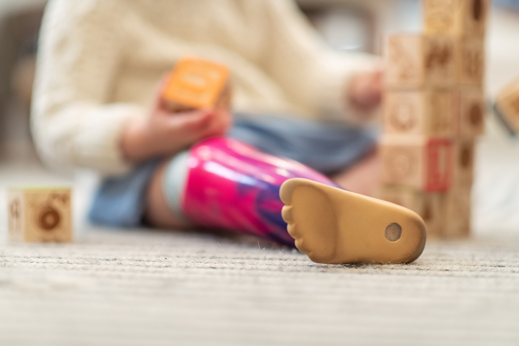 Toddler with prosthetic lower leg plays with building blocks